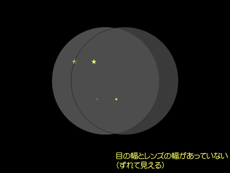 左右の視野がずれている